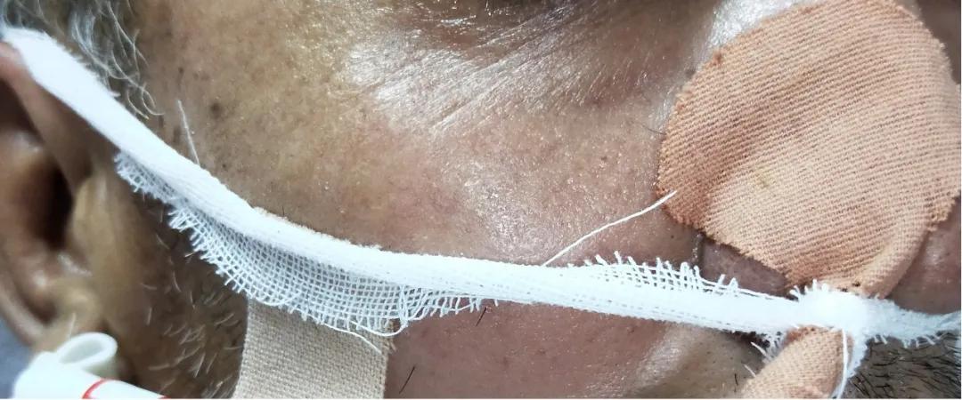 胃管滑脱后宣教不到位的整改措施,胃管滑脱护理不良事件怎么写