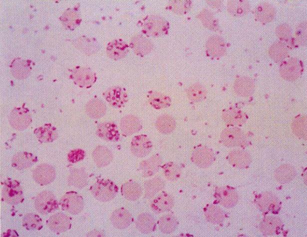 猪附红细胞体病症状及防治方法,猪附红细胞体和弓形体的区别