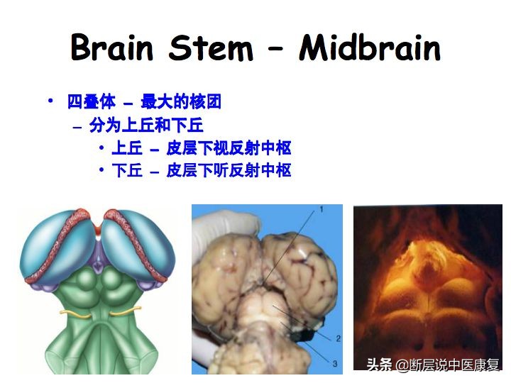 中枢神经系统断层解剖讲解,中枢神经3d解剖动画