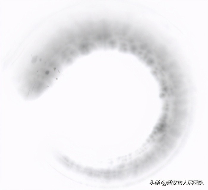 岭南林氏正骨手法,力到病除是什么意思