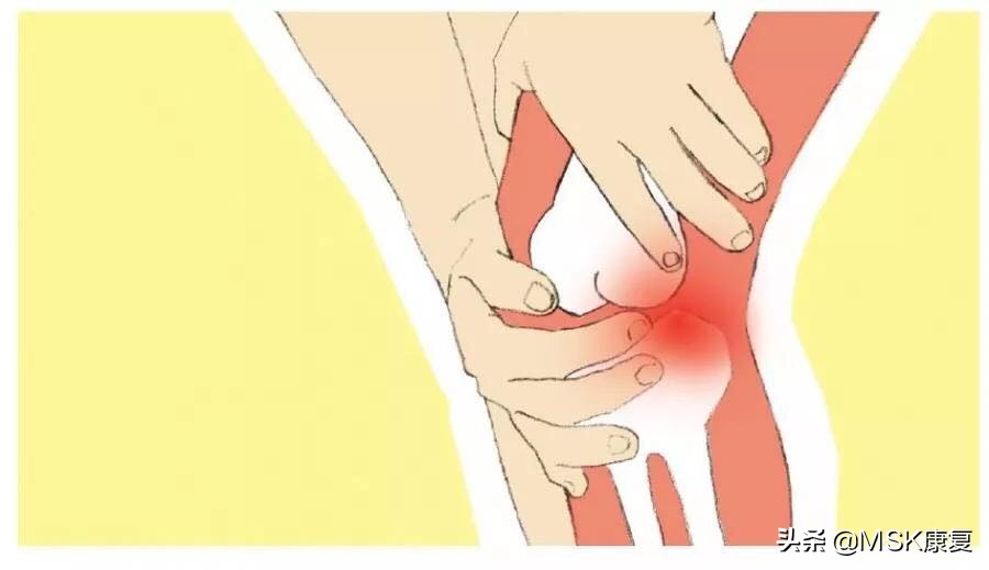 膝关节运动康复完整记录,膝关节康复大全