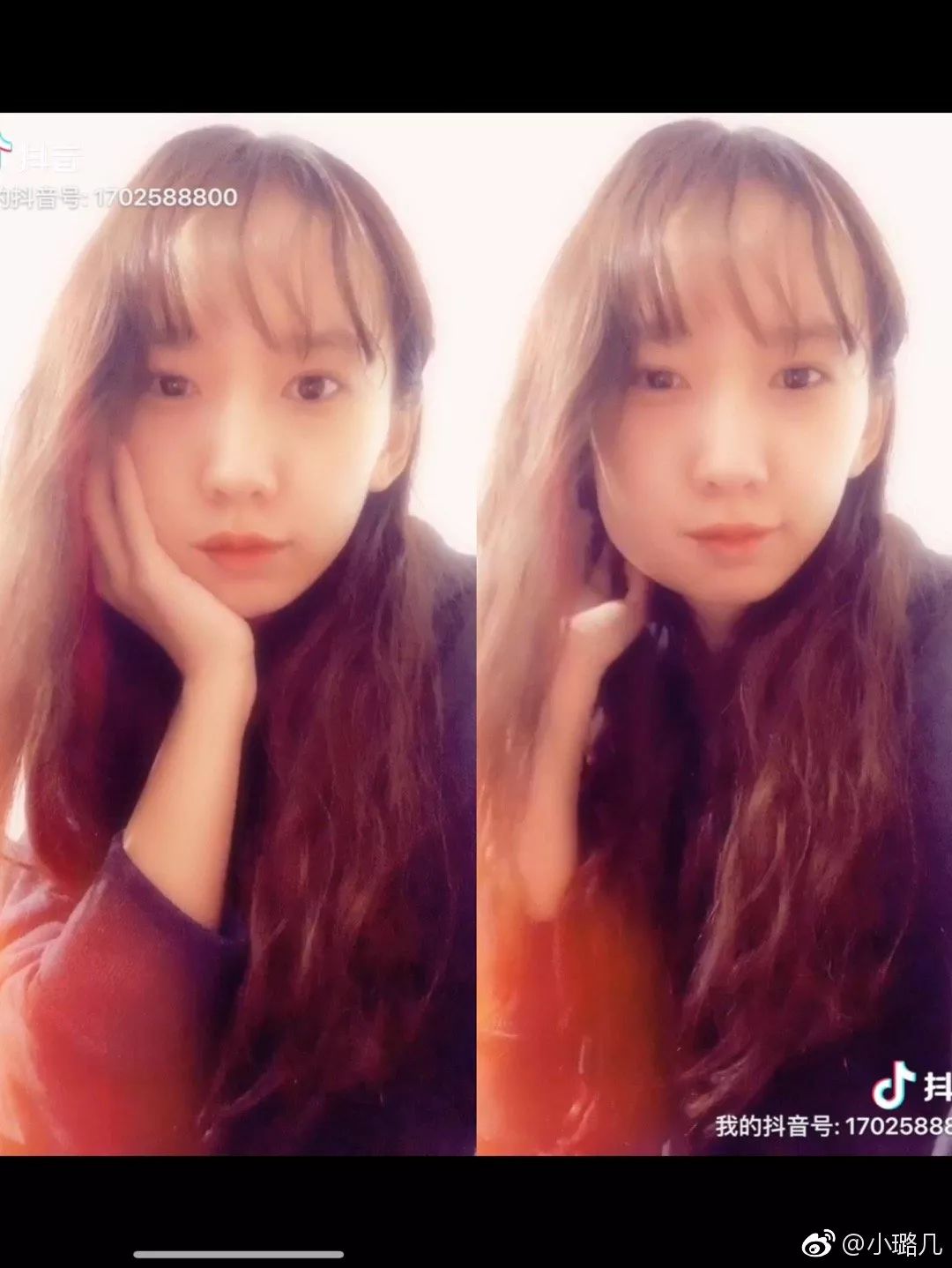 拔智齿是怎么算收费的,拔智齿是按智齿个数收费吗