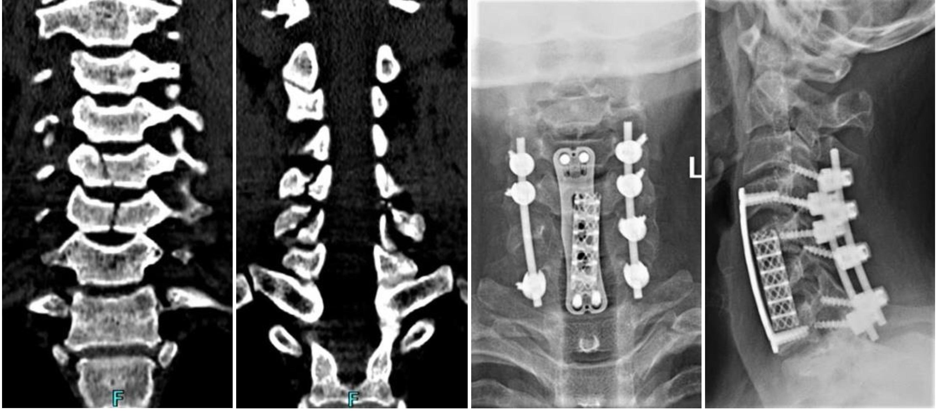 张忠根教授授课简介,李春根发改委