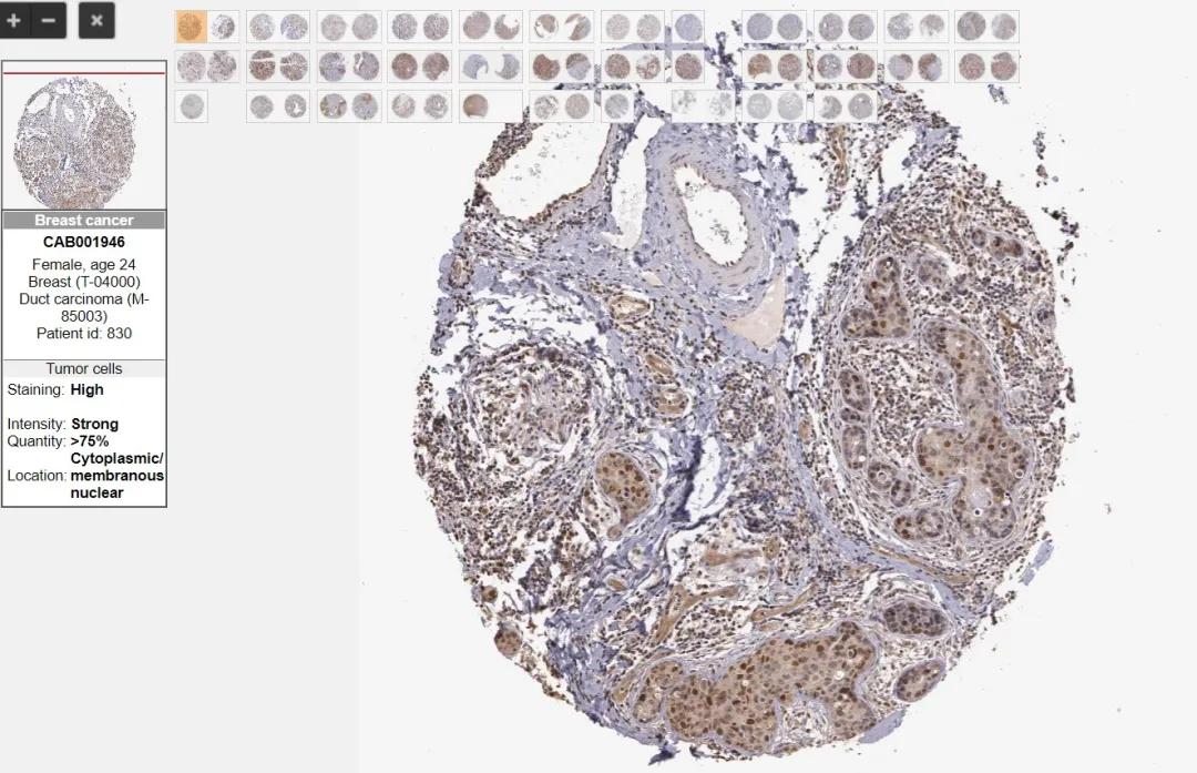 基因位置判断及实验设计题及答案,基因位置的判断及实验设计