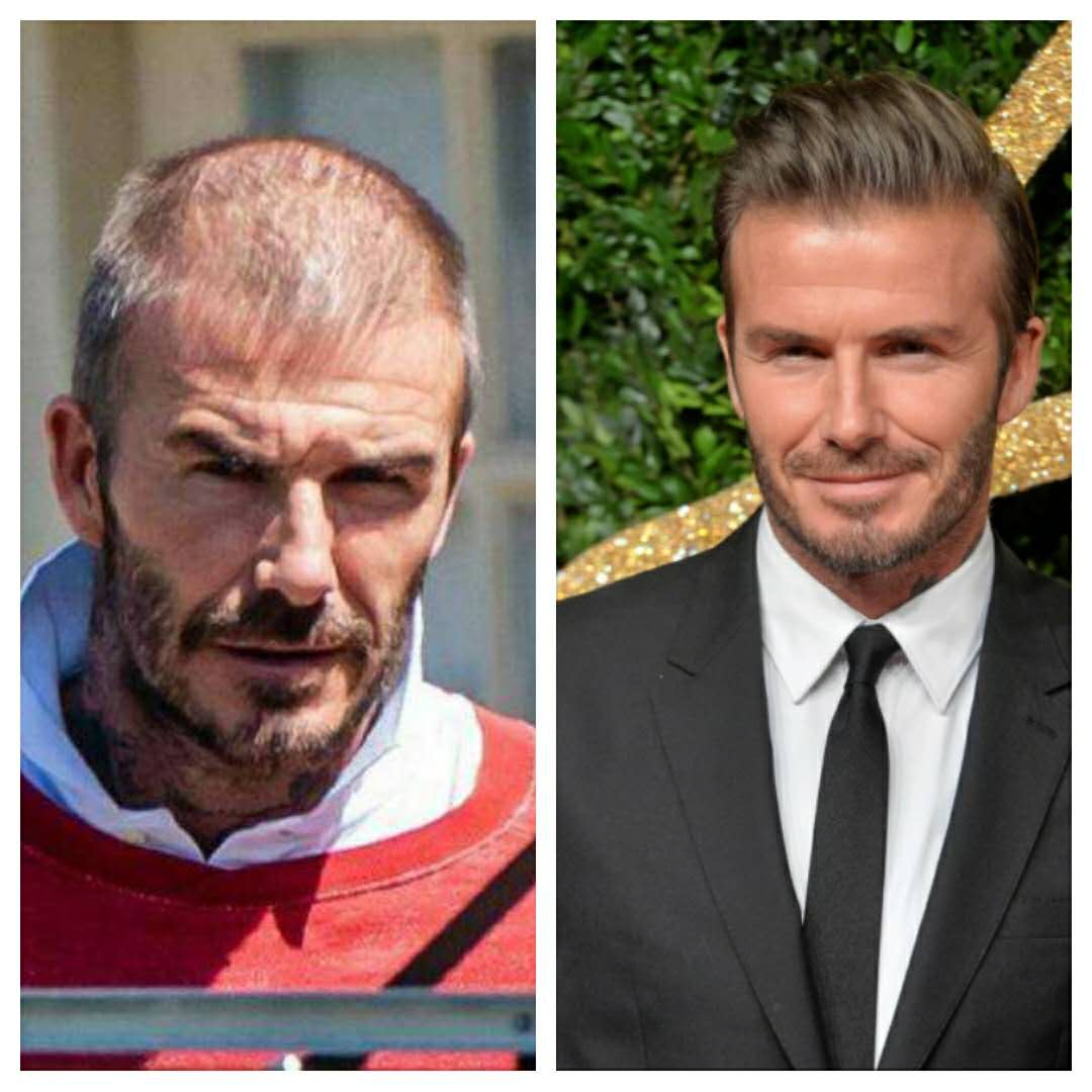 秃了秃了文案,秃了扣碎扣原版