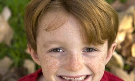 孩子长雀斑好不好,孩子为什么会长雀斑该怎么办