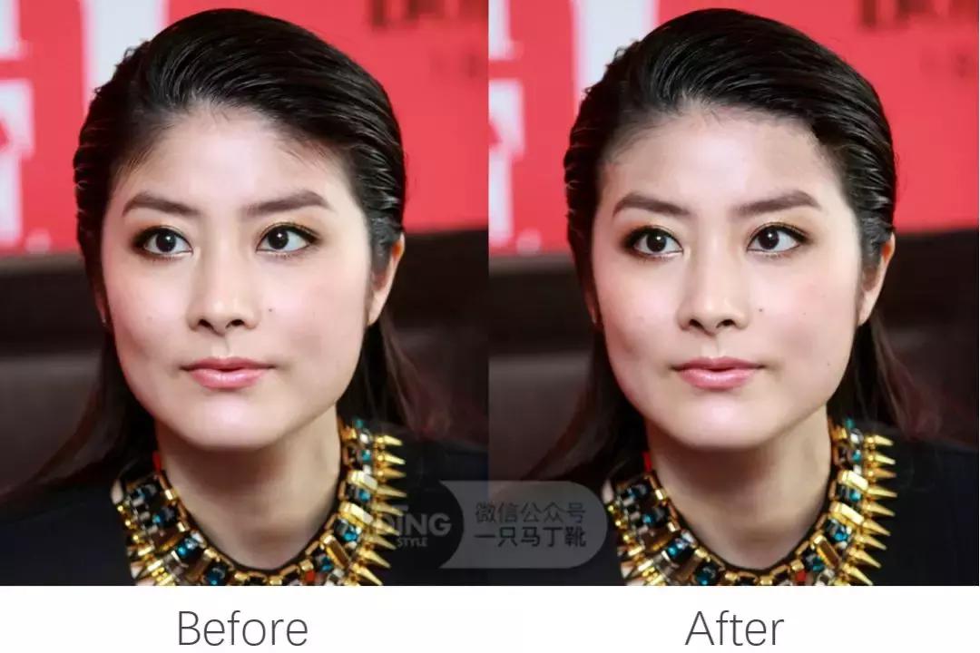 颅顶太低如何自救,颅顶低怎么自救