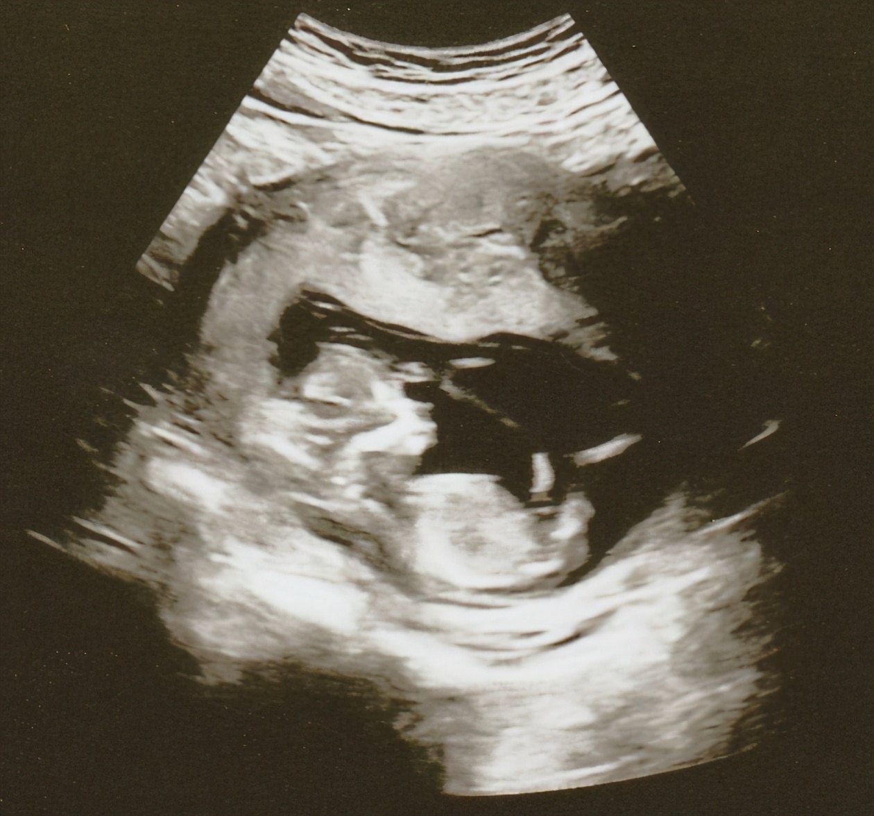 38岁香港女艺人宣布怀孕,41岁台湾女星宣布怀孕喜讯