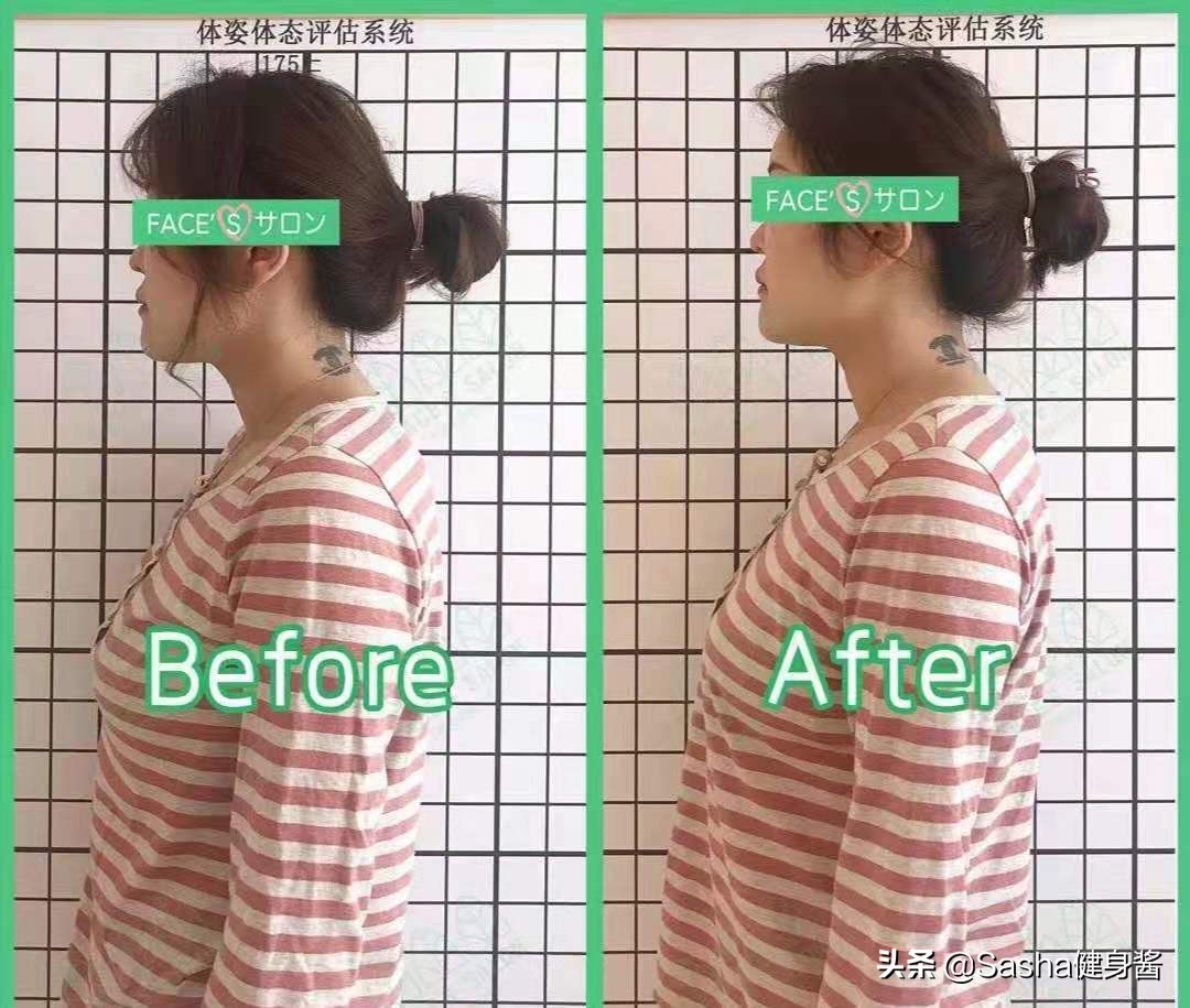 含胸驼背不怕，2个面墙动作，帮你纠正