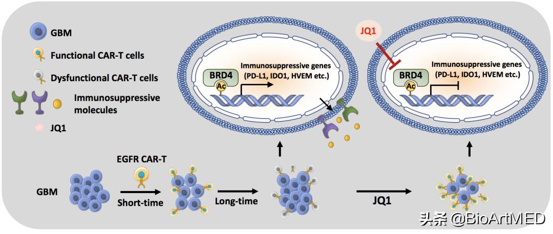 脑胶质瘤免疫疗法新突破,脑胶质瘤免疫治疗的效果如何
