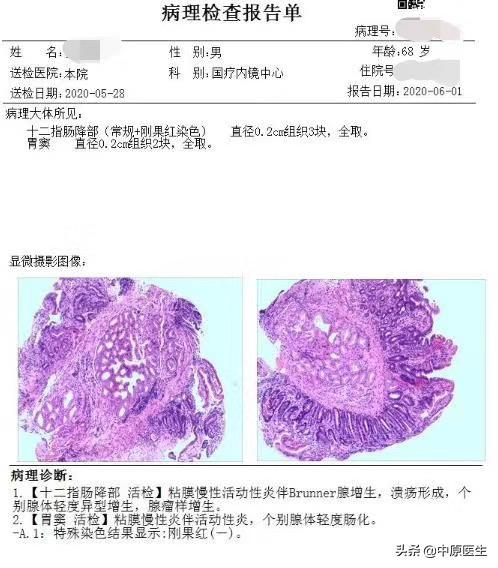 腹部疼查出淋巴瘤,男子腹痛拉肚子