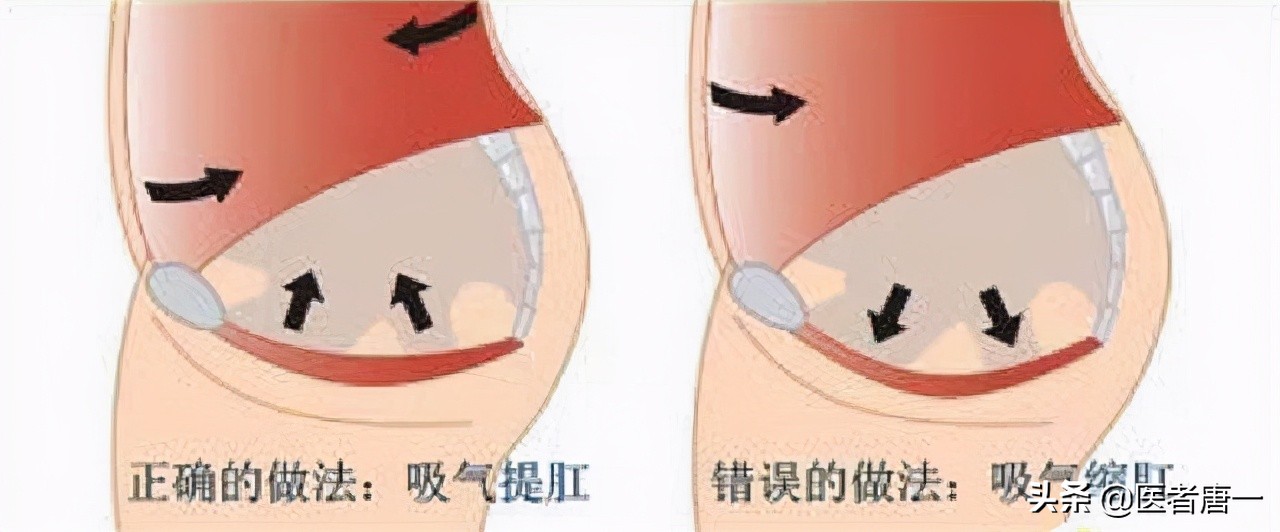 别不好意思做：提肛运动真的很养生，每天做几分钟，男女都受益