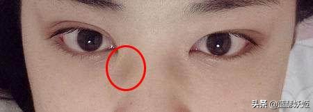 戴眼镜双眼无神怎么恢复,女生长期戴眼镜