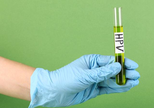 tct和hpv检查哪个确诊宫颈癌,宫颈癌和hpv筛查过程要多久