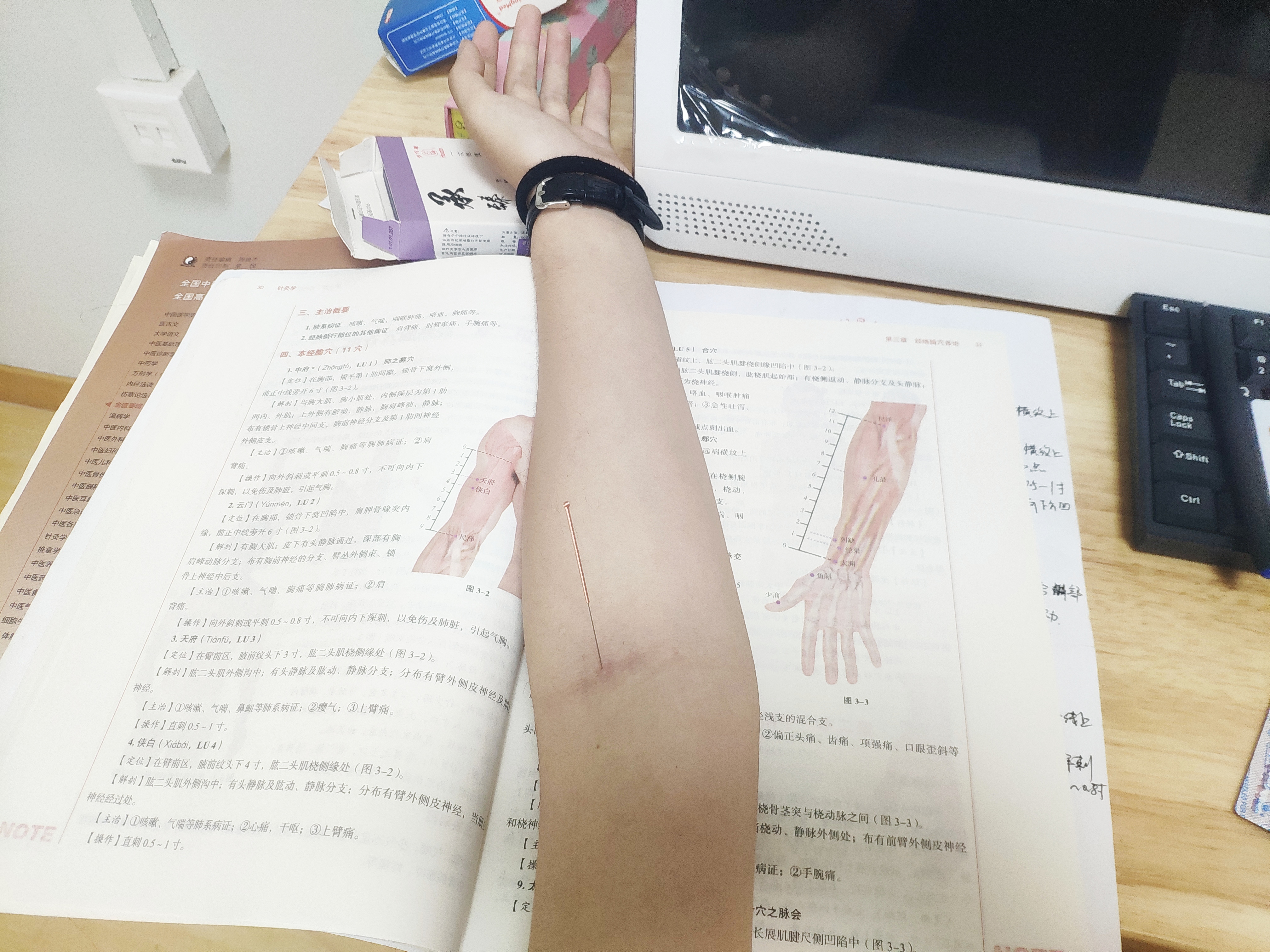 如何学好针灸学,董氏奇穴针灸学