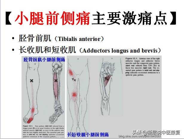 激痛点挂图,激痛点疗法笔记