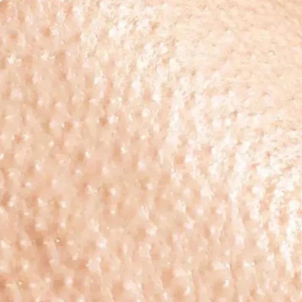 又到了穿小裙的季节，鸡皮女孩该怎么办……