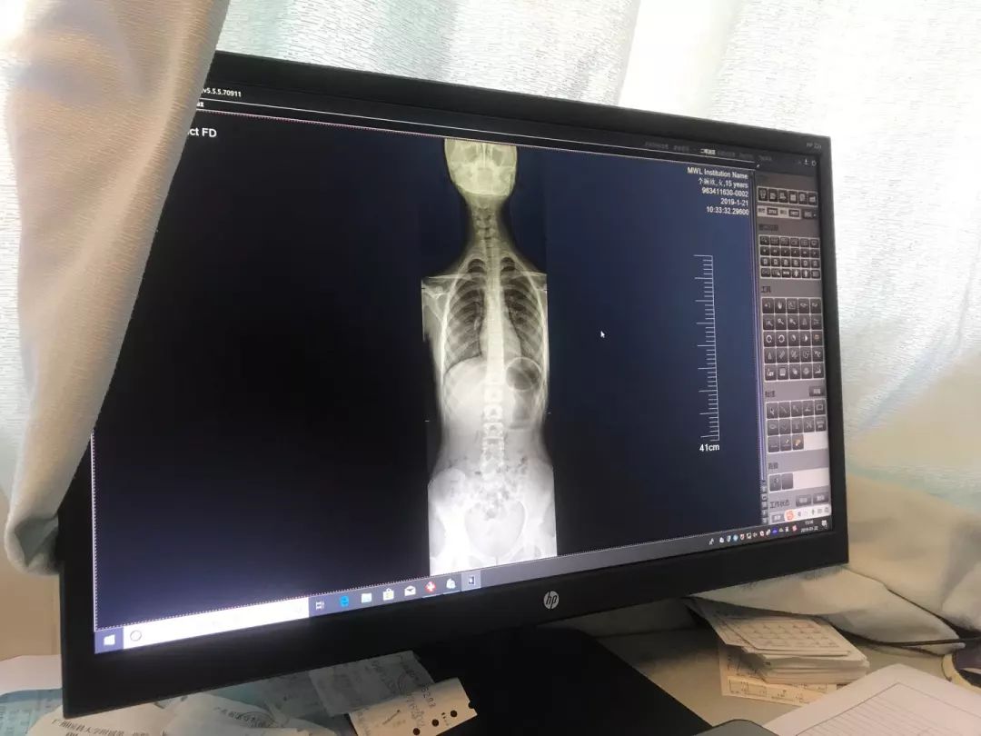 潘广华广州医科大学,广医一院潘广华