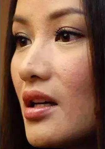 毛孔粗大肤质差如何去收缩毛孔,遮毛孔粗大收缩毛孔最有效的方法