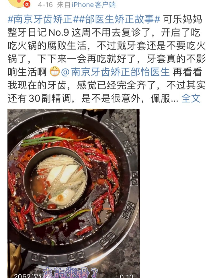 正畸医生邰怡的作品,南京牙齿矫正邰医生