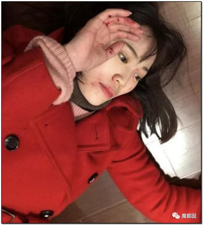 短跑名将张培萌被曝家暴反转,短跑名将张培萌家暴背后