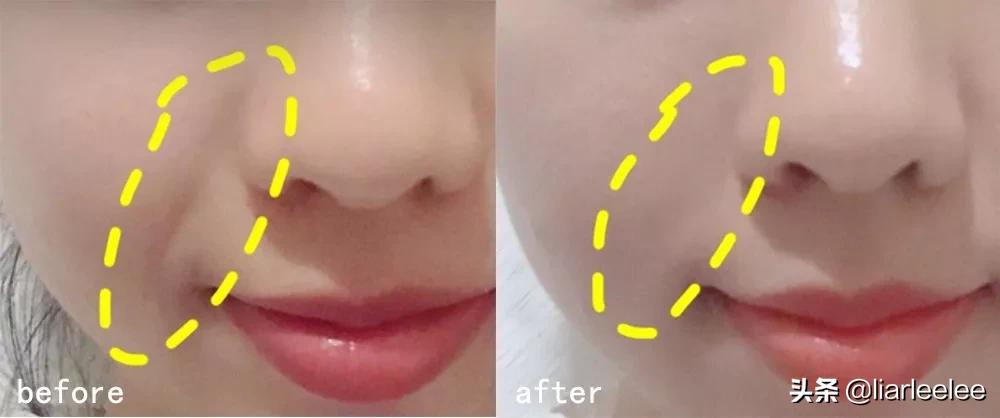 去细纹哪款眼霜值得入手百元内,又方便又好用的一款眼霜