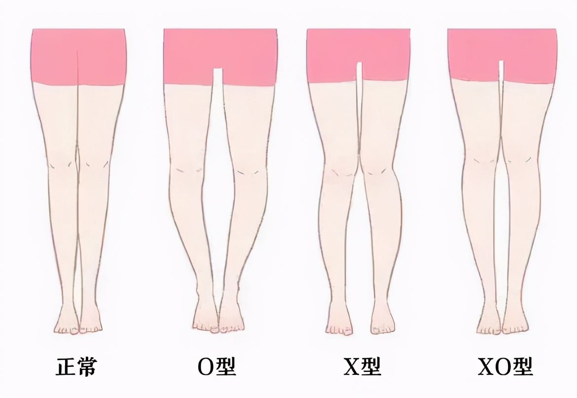三个动作让腿部线条更紧实,怎样改善腿部变得更美