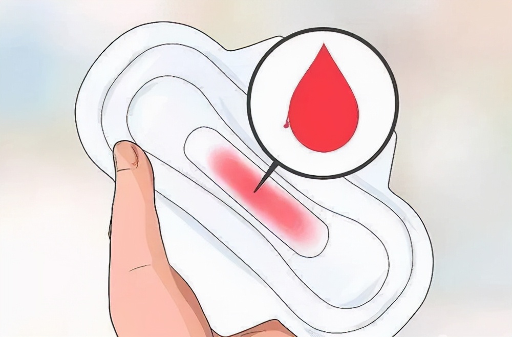 为什么月经过后还有粘稠褐色物,腺肌症月经后期褐色分泌物