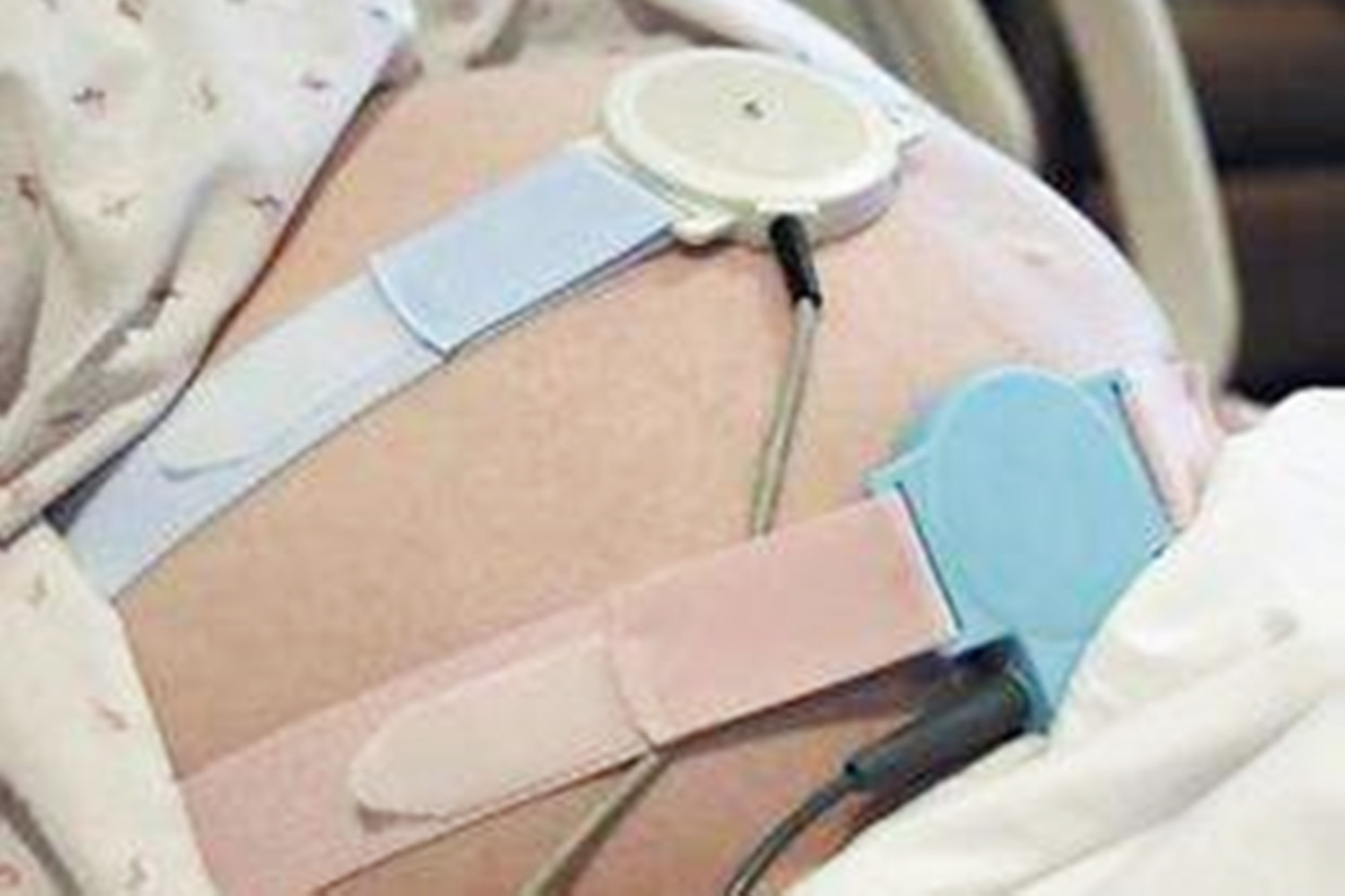 胎儿缺氧妈妈有什么感觉和症状,孕39周羊水少胎儿缺氧有什么表现