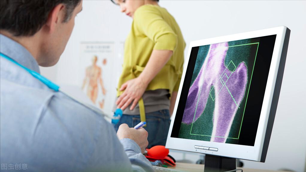 「骨质疏松故事汇No.004」喝出来的骨质疏松