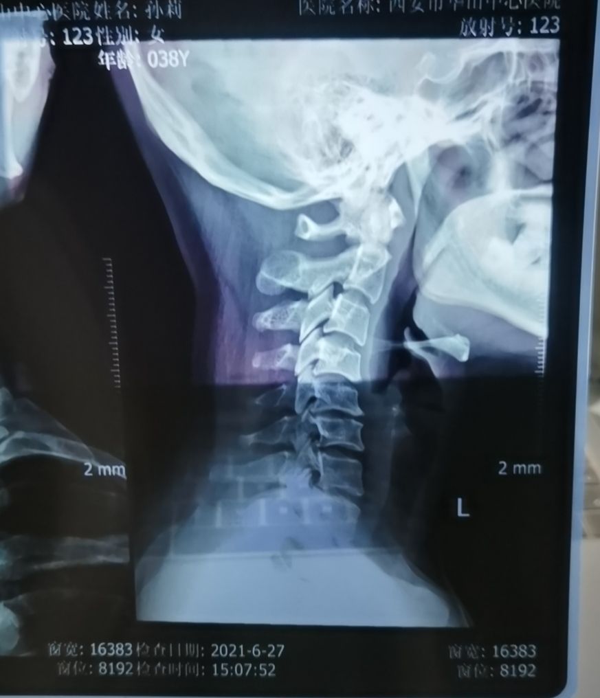 美式整脊最舒服的动作,美式整脊教程完整版