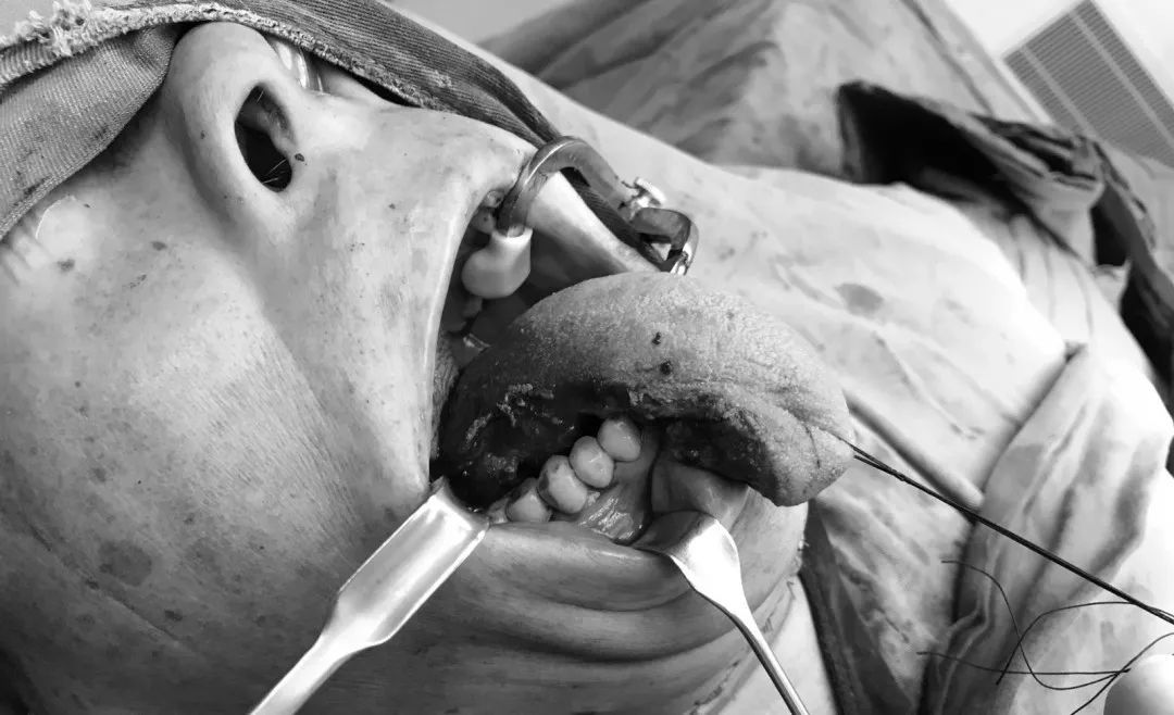 大叔被鱼刺扎伤,大叔被鱼刺伤