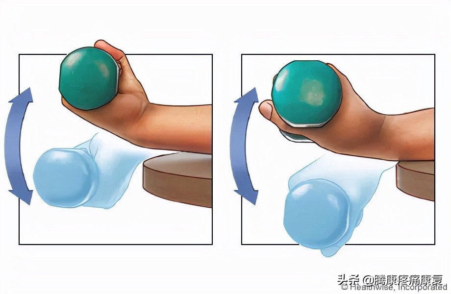 腕关节三角纤维软骨复合体损伤,三角纤维软骨损伤最佳治疗方法