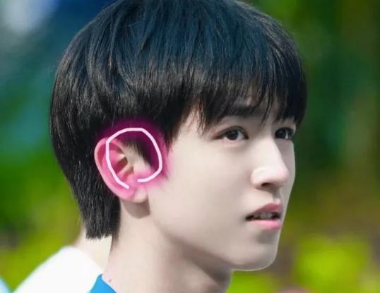 新生儿耳朵旁边有个小洞,耳朵旁边的小洞