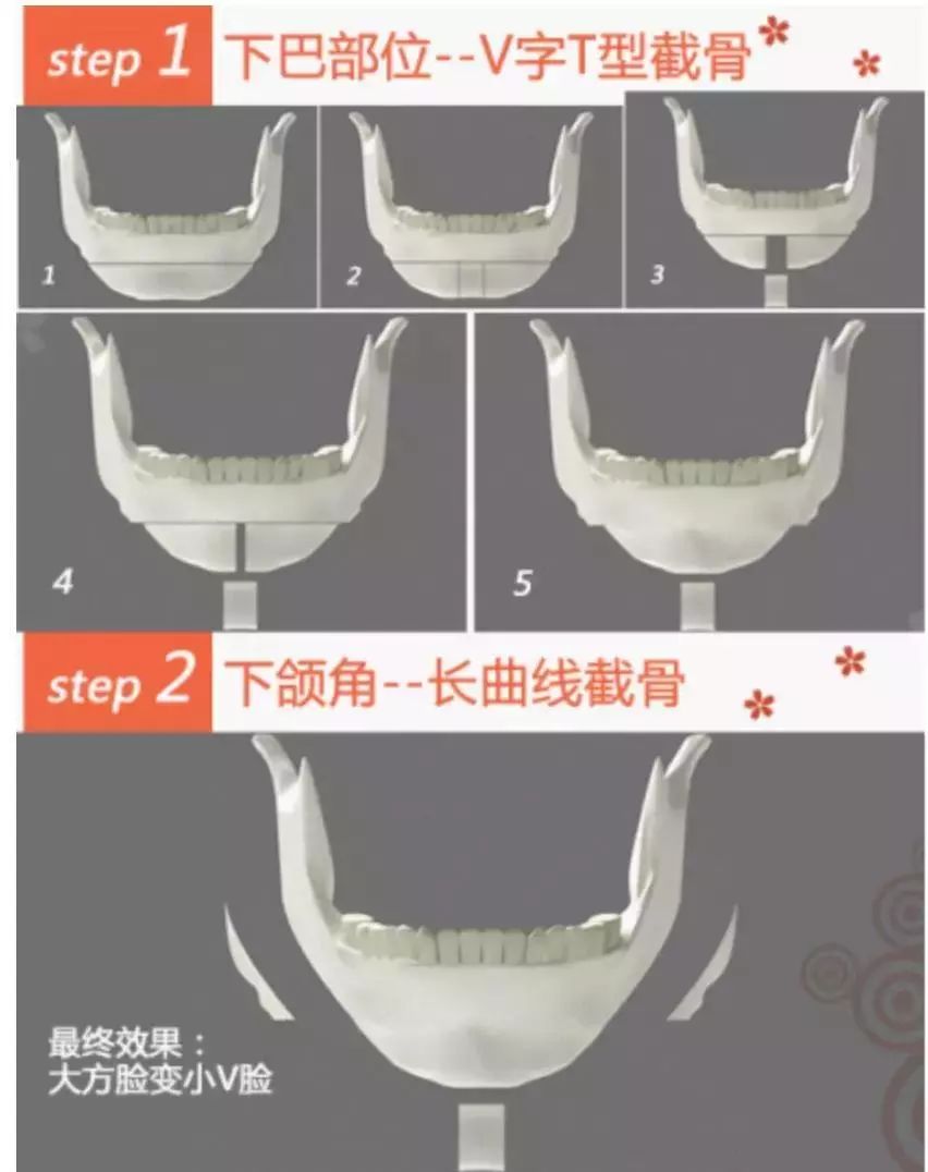 高圆圆方脸扎马尾,高圆圆方脸怎么整的