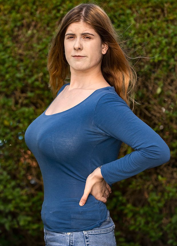 妇女生孩子后胸部变很大,生完孩子的女人胸下垂多少厘米