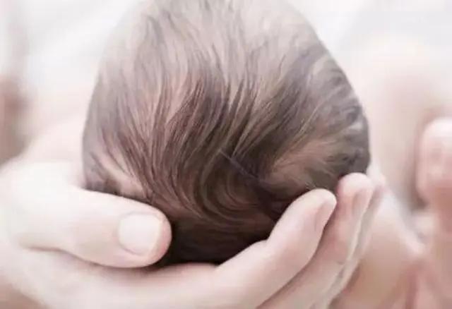 宝宝会脱发是怎么回事,如何判断宝宝脱发是正常还是缺钙