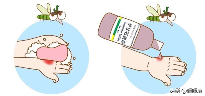 宝宝被蚊子咬了怎么驱蚊,宝宝被蚊子咬了有什么方法止痒