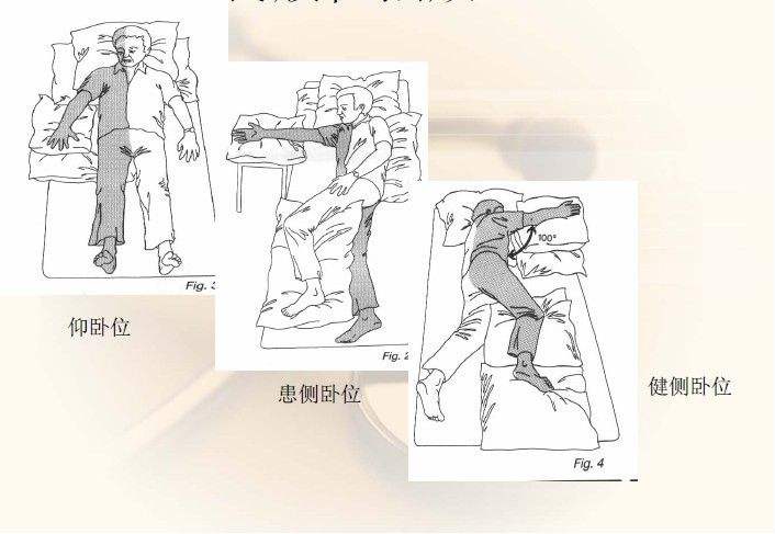 中风康复辅助方法,中风病人康复吃什么药