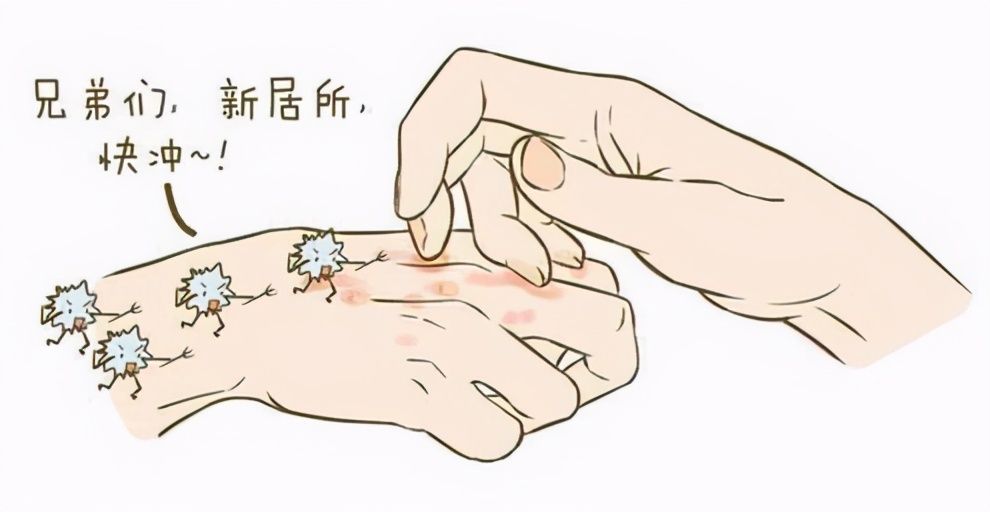 预防脚气的方法有哪些,脚气怎么预防最有效的方法