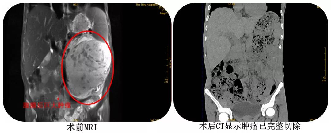 男子高烧39度,一男子高烧39.8度