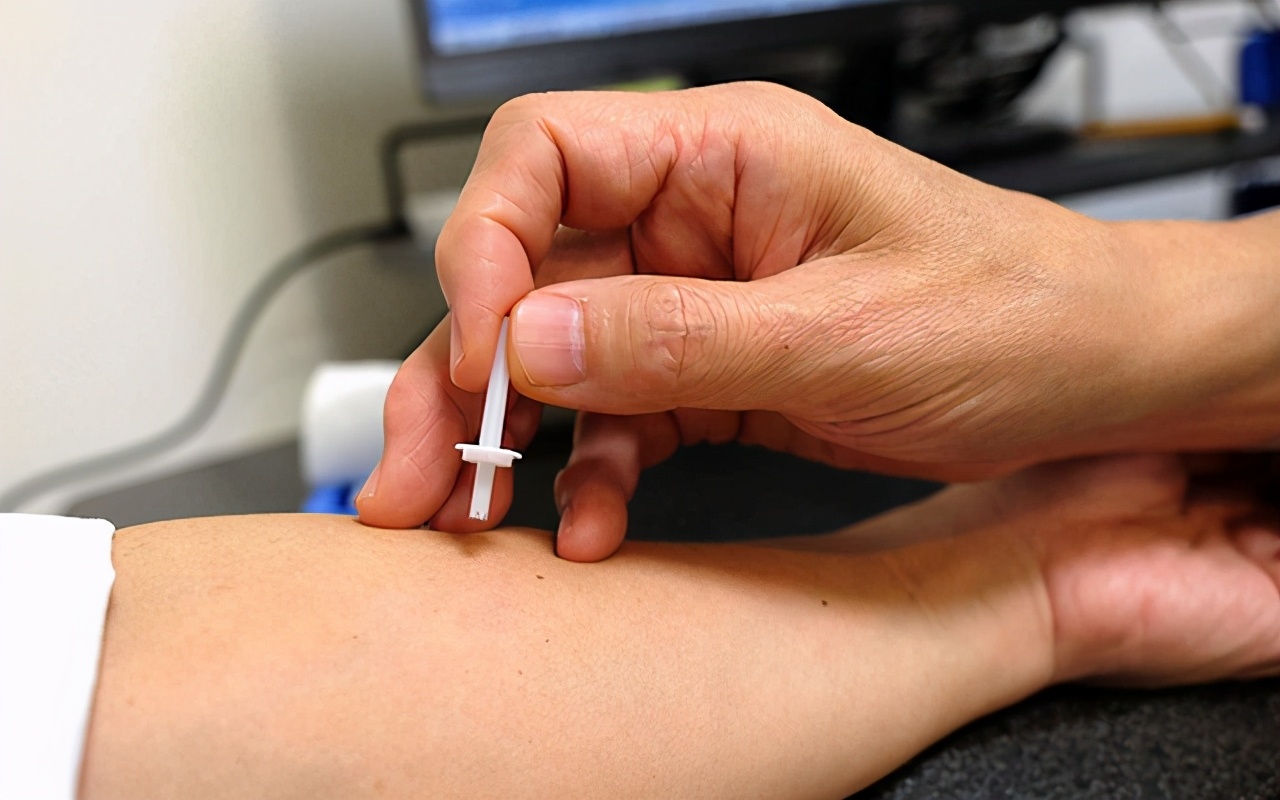 过敏性紫癜属于风湿免疫性疾病吗,过敏性紫癜肾炎是自限性疾病吗