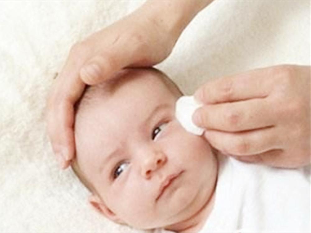 宝宝眼屎多且黄怎么办,宝宝眼屎多且黄还粘稠怎么食疗