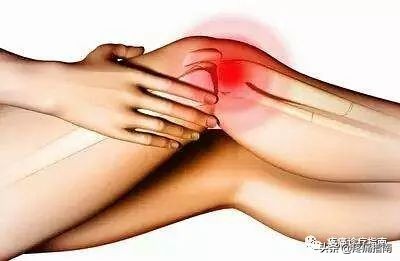 左膝关节内侧副韧带1度损伤,膝关节外侧副韧带撕裂的症状