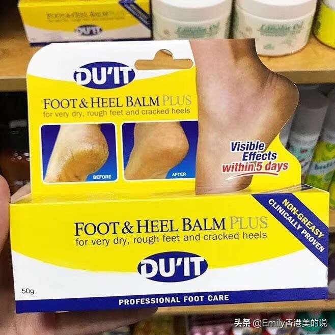 嘴唇干裂眼干涩手脚心热吃什么药,冬季手干手裂脚裂怎么治