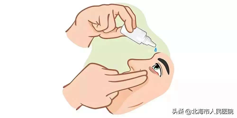 飞虫进眼用手揉致角膜感染溃烂,飞虫进眼睛出来后眼睛红血丝