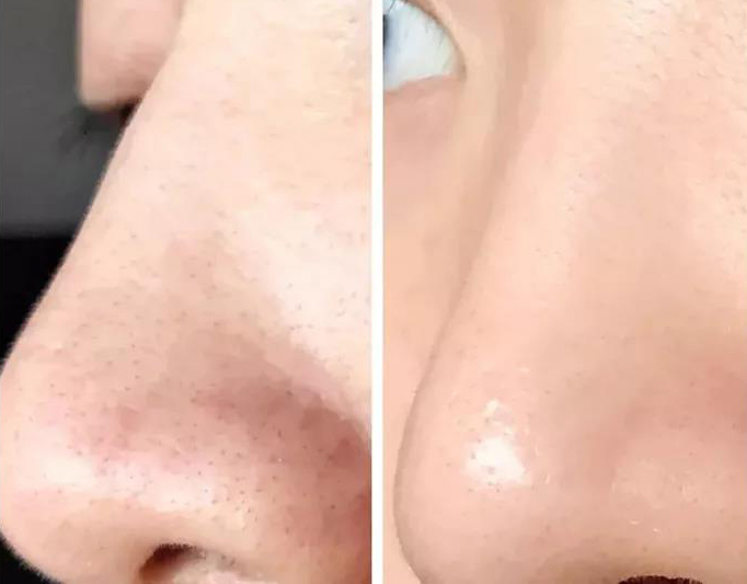 成品面膜逐渐被淘汰，女生开始青睐“现做”面膜，网友：用着放心