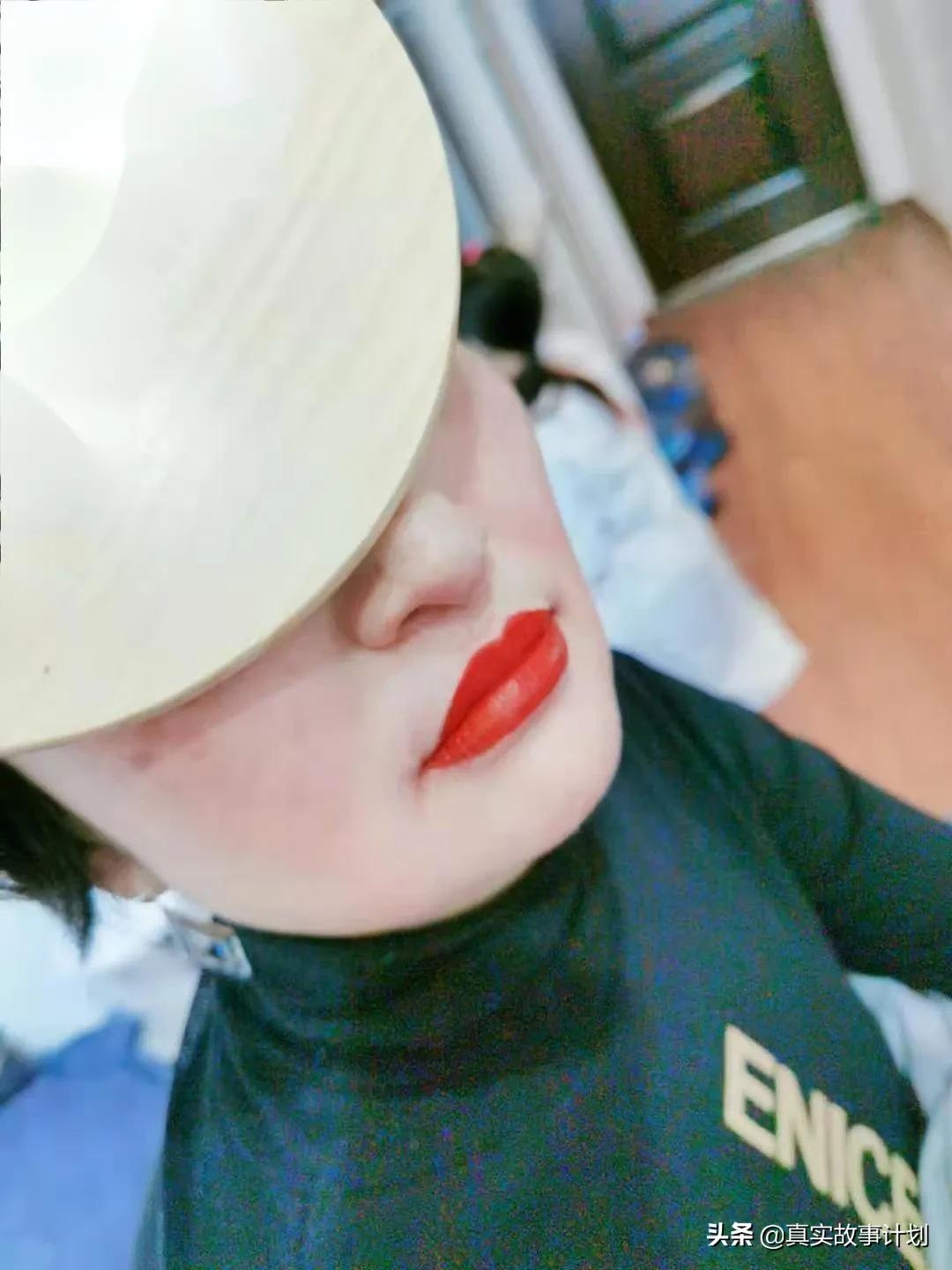 老年人提眉去眼袋,老年人美容祛斑去哪里