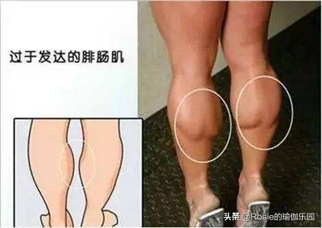 跑步减肥小腿粗？小腿矫正能增高？只需1双手睡前5分钟小腿细2cm