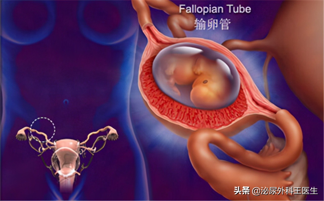 什么是阴式b超检查时有什么感觉,阴式b超检查前注意事项